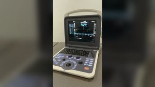جهاز الموجات فوق الصوتية BR-US22