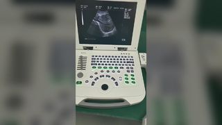 نظام تشخيص بالموجات فوق الصوتية للكمبيوتر المحمول الرقمي بالكامل 80 عنصر BR-US11