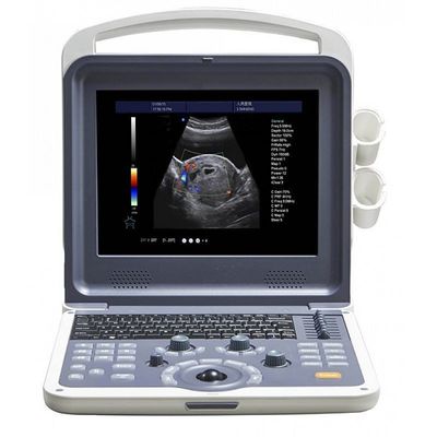 4D Portable color doppler machine
