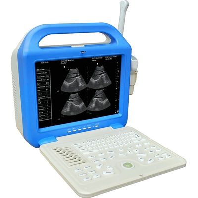 Digital Laptop Ultrasonic Diagnosis Equipment