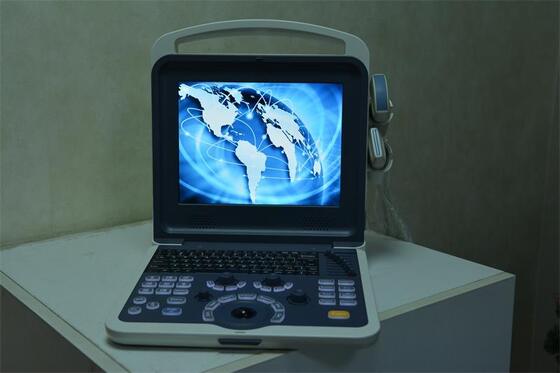 Portable Color doppler ultrasonic Diagnostic System  80 elments