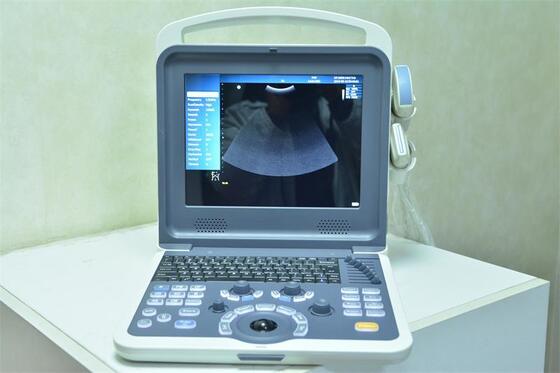 Portable Color doppler ultrasonic Diagnostic System  80 elments