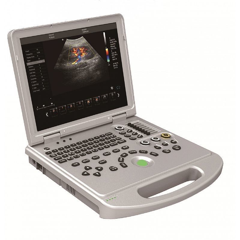 4D laptop color doppler ultrasound system