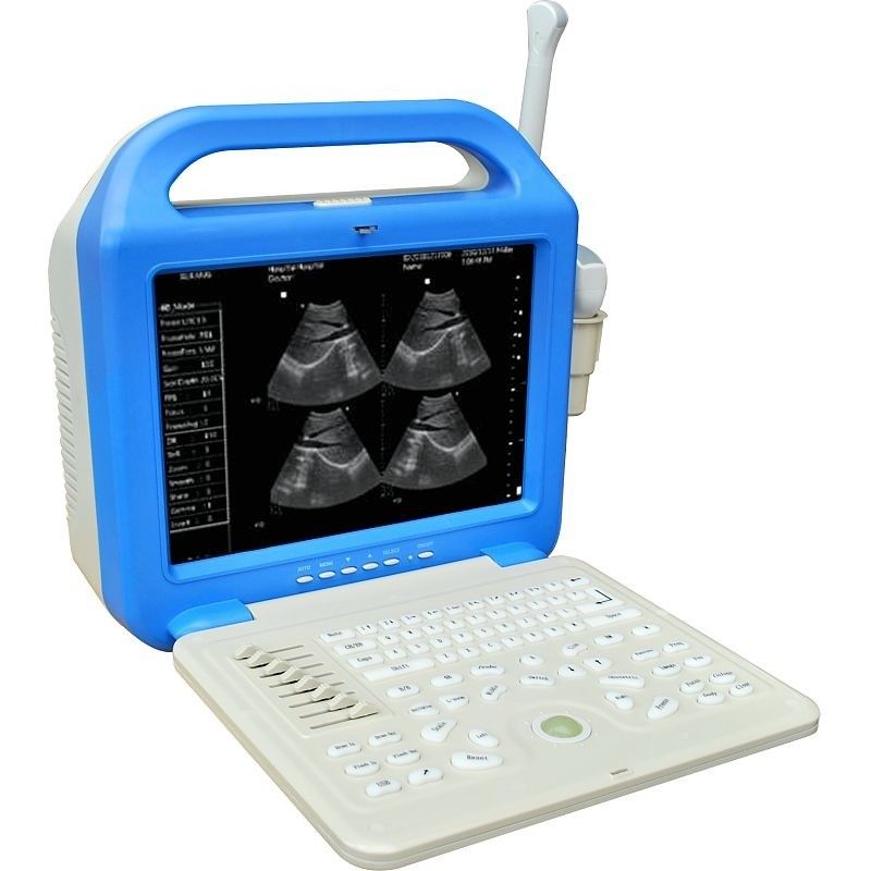 Digital Laptop Ultrasonic Diagnosis Equipment