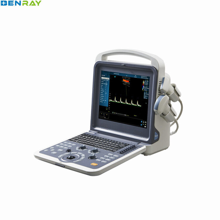 Portable Color doppler ultrasonic Diagnostic System  80 elments